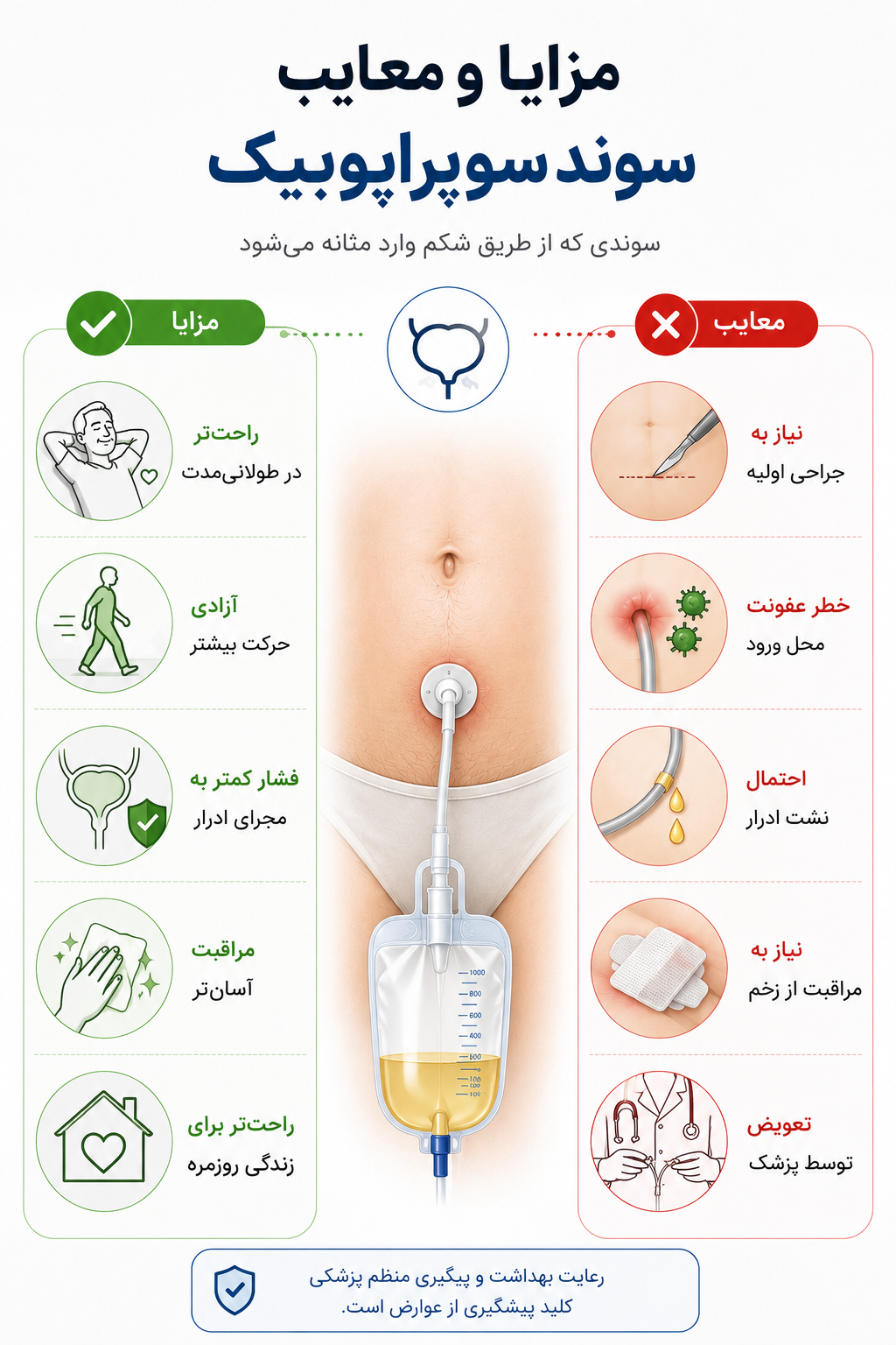 مزایا و معایب سوند فولی
