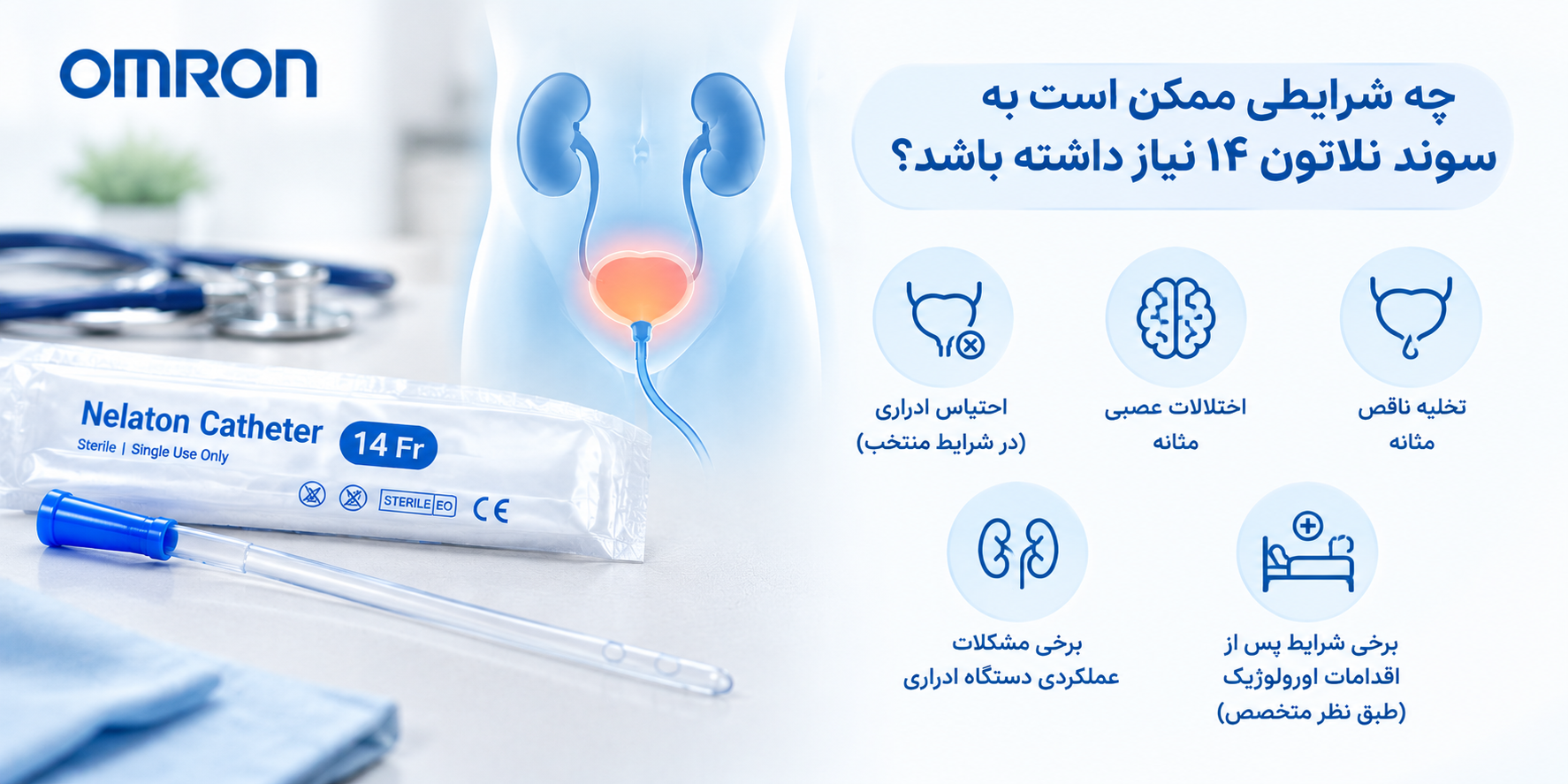 چه شرایطی ممکن است به سوند نلاتون ۱۴ نیاز داشته باشد؟
